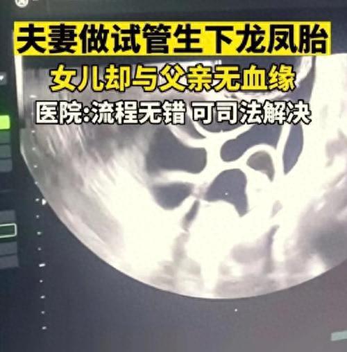 血源攻略宇宙之女(血源游戏怎么选女角色)插图