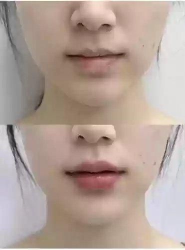 厚嘴唇阵容